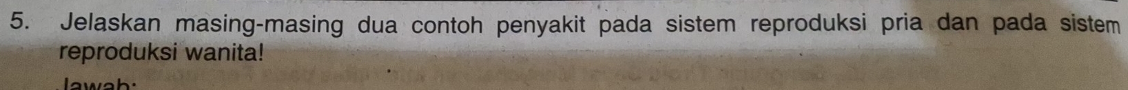 Jelaskan masing-masing dua contoh penyakit pada sistem reproduksi pria dan pada sistem 
reproduksi wanita! 
lawah: