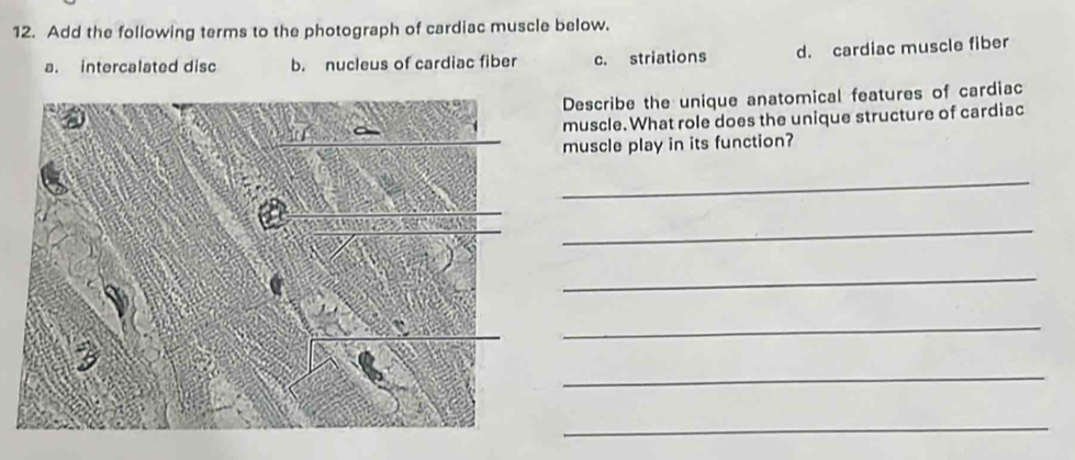 Add the following terms to the photograph of cardiac muscle below.
a. intercalated disc b. nucleus of cardiac fiber c. striations d. cardiac muscle fiber
Describe the unique anatomical features of cardiac
muscle. What role does the unique structure of cardiac
muscle play in its function?
_
_
_
_
_
_