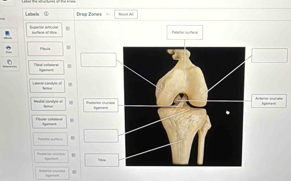 Solved: Label the structures of the knee. Labels Drop Zones Reset All ...