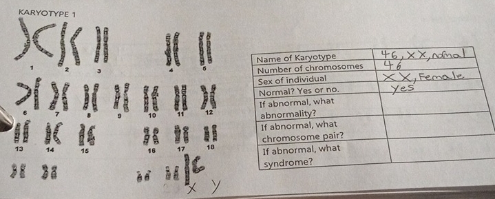 KARYOTYPE 1 
B