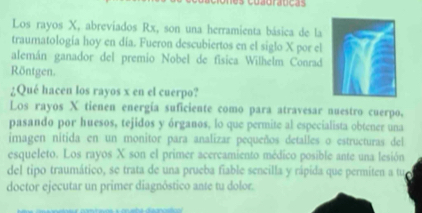 Los rayos X, abreviados Rx, son una herramienta básica de la 
traumatología hoy en día. Fueron descubiertos en el siglo X por el 
alemán ganador del premio Nobel de física Wilhelm Conrad 
Röntgen. 
¿Qué hacen los rayos x en el cuerpo? 
Los rayos X tienen energía suficiente como para atravesar nuestro cuerpo, 
pasando por huesos, tejidos y órganos, lo que permite al especialista obtener una 
imagen nitida en un monitor para analizar pequeños detalles o estructuras del 
esqueleto. Los rayos X son el primer acercamiento médico posible ante una lesión 
del tipo traumático, se trata de una prueba fiable sencilla y rápida que permiten a tue 
doctor ejecutar un primer diagnôstico ante tu dolor.