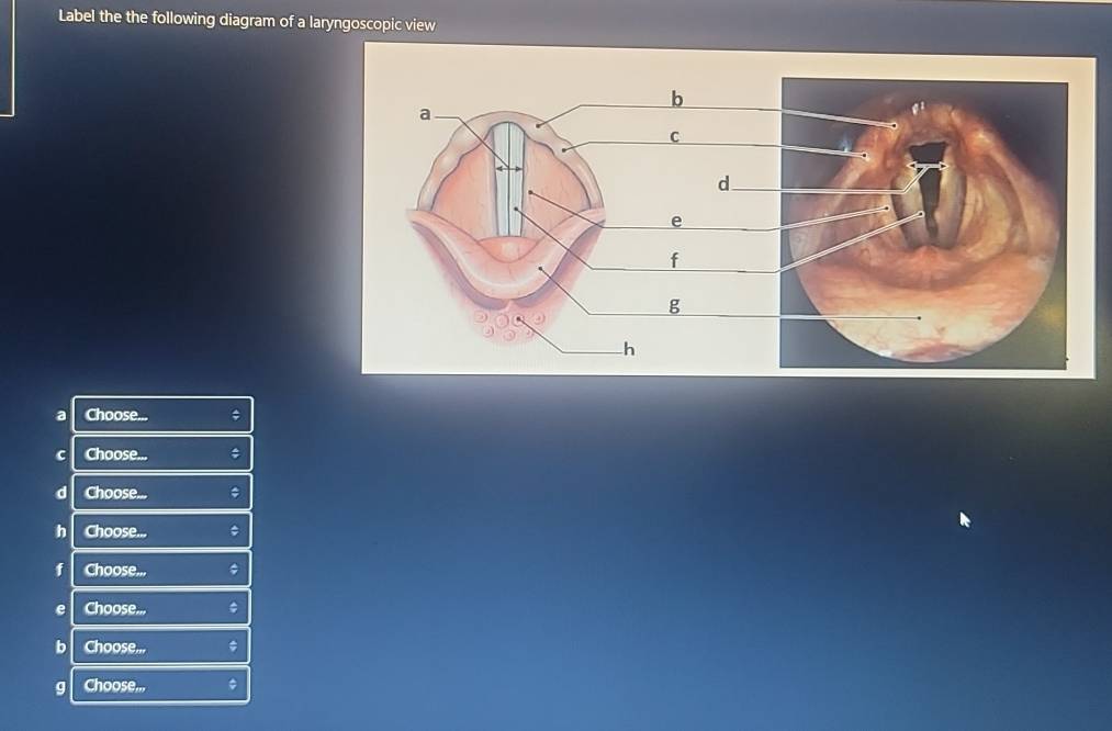 Label the the following diagram of a laryngoscopic view 
a Choose... ; 
c Choose... 
d Choose... ; 
h Choose... 
f Choose.,. 
e Choose... 
b Choose... 
g Choose..,