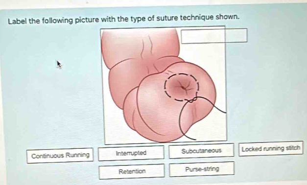Solved: Label the following picture with the type of suture technique ...