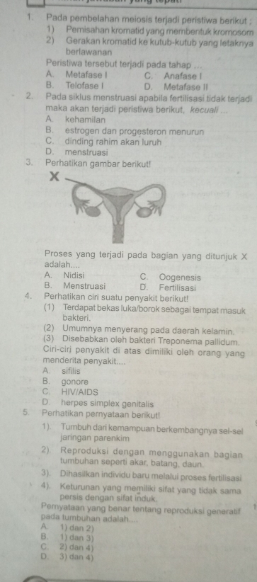 Pada pembelahan meiosis terjadi peristiwa berikut ;
1) Pemisahan kromatid yang membentuk kromosom
2) Gerakan kromatid ke kutub-kutub yang letaknya
berlawanan
Peristiwa tersebut terjadi pada tahap ...
A. Metafase I C. Anafase I
B. Telofase I D. Metafase II
2. Pada siklus menstruasi apabila fertilisasi tidak terjadi
maka akan terjadi peristiwa berikut, kecuali ...
A. kehamilan
B. estrogen dan progesteron menurun
C. dinding rahim akan luruh
D. menstruasi
3. Perhatikan gambar berikut!
Proses yang terjadi pada bagian yang ditunjuk X
adalah....
A. Nidisi C. Oogenesis
B. Menstruasi D. Fertilisasi
4. Perhatikan ciri suatu penyakit berikut!
(1) Terdapat bekas luka/borok sebagai tempat masuk
bakteri.
(2) Umumnya menyerang pada daerah kelamin.
(3) Disebabkan oleh bakteri Treponema pallidum.
Ciri-ciri penyakit di atas dimiliki oleh orang yang
menderita penyakit....
A. sifilis
B. gonore
C. HIV/AIDS
D. herpes simplex genitalis
5. Perhatikan pernyataan berikut!
1). Tumbuh dari kemampuan berkembangnya sel-sel
jaringan parenkim
2). Reproduksi dengan menggunakan bagian
tumbuhan seperti akar, batang, daun.
3). Dihasilkan individu baru melalui proses fertilisasi
4). Keturunan yang memiliki sifat yang tidak sama
persis dengan sifat induk.
Pemyataan yang benar tentang reproduksi generatif
pada tumbuhan adalah...
A. 1) dan 2)
B. 1) dan 3)
C. 2) dan 4)
D. 3) dan 4)