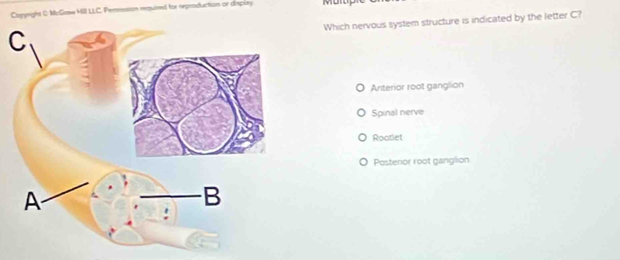 Copyright ( McGaaw MIII LLC. Permasion requised for reproduction or displty.
Which nervous system structure is indicated by the letter C?
C
Anterior root ganglion
Spinal nerve
Rootlet
Posterior root ganglion