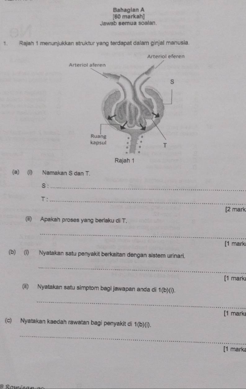 Bahagian A 
[60 markah] 
Jawab semua soalan. 
1. Rajah 1 menunjukkan struktur yang terdapat dalam ginjal manusia. 
(a) (i) Namakan S dan T. 
S:_ 
T:_ 
[2 mark 
(ii) Apakah proses yang berlaku di T. 
_ 
[1 mark 
(b) (i) Nyatakan satu penyakit berkaitan dengan sistem urinari. 
_ 
[1 mark 
(ii) Nyatakan satu simptom bagi jawapan anda di 1(b)(i). 
_ 
[1 mark 
(c) Nyatakan kaedah rawatan bagi penyakit di 1(b)(i). 
_ 
[1 marka