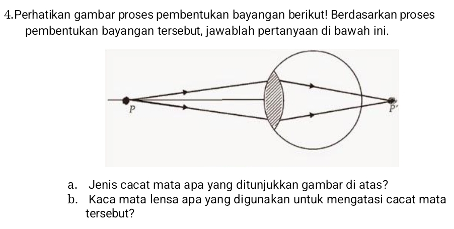 Perhatikan gambar proses pembentukan bayangan berikut! Berdasarkan proses 
pembentukan bayangan tersebut, jawablah pertanyaan di bawah ini. 
a. Jenis cacat mata apa yang ditunjukkan gambar di atas? 
b. Kaca mata lensa apa yang digunakan untuk mengatasi cacat mata 
tersebut?