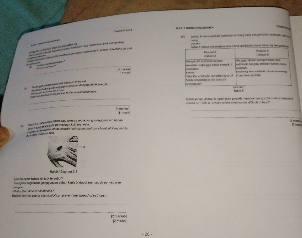 BAB 1 MIKROORGANISMA 
TINGKATE 
TINGKATAN S 
(d) Jadual 6 menunjukkan maklumat tentang cara pengambian antibiotk slall sw 
e m nãa 
orang 
SOALAN 10 (NEDAH 2024 36 (E MARKAH)] 
agaión patgen aok aia neujus kepada prosedur kesihatan yang dijalankan untuk menghalang 
e ach 
w antibiotics were taken by two pa 
he pelcgers bapr a chrque reem to the healthcare procedure carried out to prevent infections caused 
_Sital de plg Aodkah maksud patogen? 
[1 markah] 
[1 mark] 
(b) Mencagah adalsh lebih balk daripada morawat. 
Nystakan bubung kait ungkapan tersebut dengan teknik aseptik. 
Crovection la better than cur 
Stale the relation of the phrase to the aseptic technique. 
Table 6 
_Berdasarkan Jadual 6, terangkan pesakit manakah yang sukar untuk sembuh? 
_ 
Rased on Table 6. explain which patients are difficult to heal? 
[1 markah] 
_ 
[1 mark] 
_ 
(2 Haan 6.) menuŋjukkah saian satu teknik aseptik yang menggunakan banan [2 marx 
ksmia X yang disapu pada permukaan kulit manusia. 
[2 mand 
Diagrue 5 I shows one of the aseptic techniques that use chemical X applied to 
he surface of human skin. 
Rajah / Diagram 6.1 
Apakah nama bahan kimia X tersebut? 
Terangkan bagaimana penggunaan bahan kimia X dapat mencegah penyebaran 
au o 
What is the name of chemical X? 
Explain how the use of chemical X can prevent the spread of pathogen. 
_ 
_ 
[2 markah] 
[2 marks] 
- 20 -