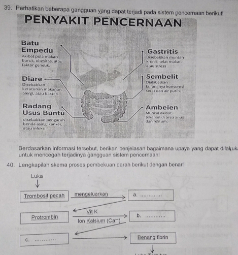 Perhatikan beberapa gangguan yang dapat terjadi pada sistem pence berikut! 
Berdasarkan informasi tersebut, berikan penjelasan bagaimana upaya yang dapat dilakuk 
untuk mencegah terjadinya ġangguan sistem pencernaan! 
40. Lengkapilah skema proses pembekuan darah berikut dengan benar! 
Luka 
Trombosit pecah mengeluarkan a. _.. . ... ... 
Vit K 
Protrombin Ion Kalsium (Ca^(++))
c. _Benang fibrin