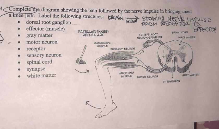 4C Complete the diagram showing the path followed by the nerve impulse in bringing about
a knee jerk. Label the following structures:
dorsal root ganglion
effector (muscle) PATELLAR (KNEE)
gray matter REFLEX ARC DORSAL ROOT SPINAL CORD
motor neuron QUADRICEPS NELIRON/GANGLION WHITE MATTER
MLISCLE
receptor SENSORY NEURON
sensory neuron
spinal cord
synapse
white matter HAMSTRING
MUISCLE MOTOR NELIRON GRAY MATTER
INTERNEURON