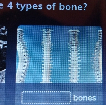 4 types of bone? 
bones