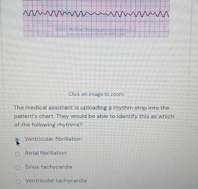 Click on image to zoom
The medical assistant is uploading a rhythm strip into the
patient's chart. They would be able to identify this as which
of the following rhythms?
Ventricular fibrillation
Atrial fibrillation
Sinus tachycardia
Ventricular tachycardia