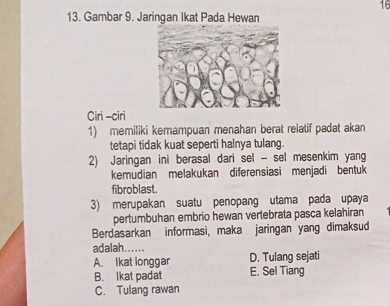 16
13. Gambar 9. Jaringan Ikat Pada Hewan
Ciri -ciri
1) memiliki kemampuan menahan berat relatif padat akan
tetapi tidak kuat seperti halnya tulang.
2) Jaringan ini berasal dari sel - sel mesenkim yang
kemudian melakukan diferensiasi menjadi bentuk
fibroblast.
3) merupakan suatu penopang utama pada upaya
pertumbuhan embrio hewan vertebrata pasca kelahiran
Berdasarkan informasi, maka jaringan yang dimaksud
adalah......
A. Ikat longgar D. Tulang sejati
B. Ikat padat E. Se! Tiang
C. Tulang rawan