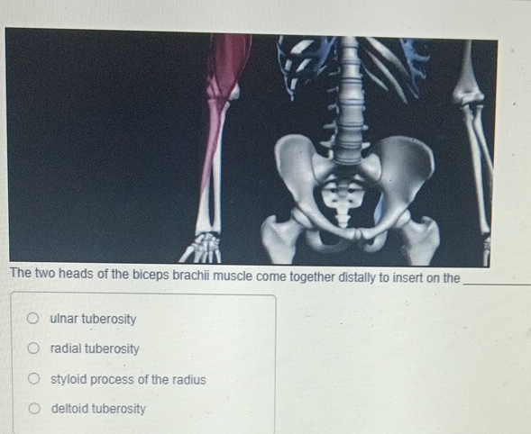 Solved: The two heads of the biceps brachii muscle come together ...