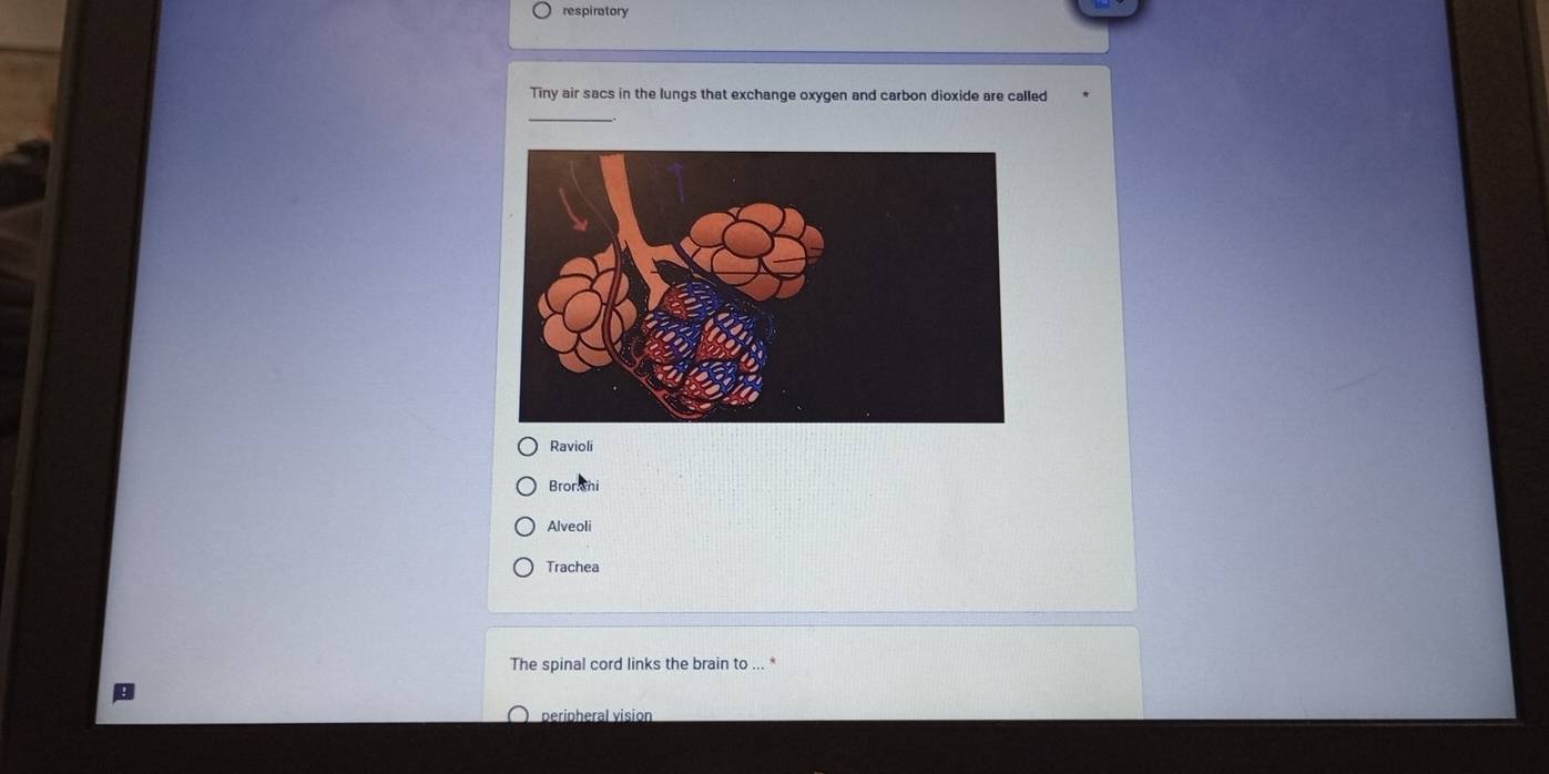 respiratory
Tiny air sacs in the lungs that exchange oxygen and carbon dioxide are called
_
Ravioli
Bronhi
Alveoli
Trachea
The spinal cord links the brain to ... *
peripheral visión