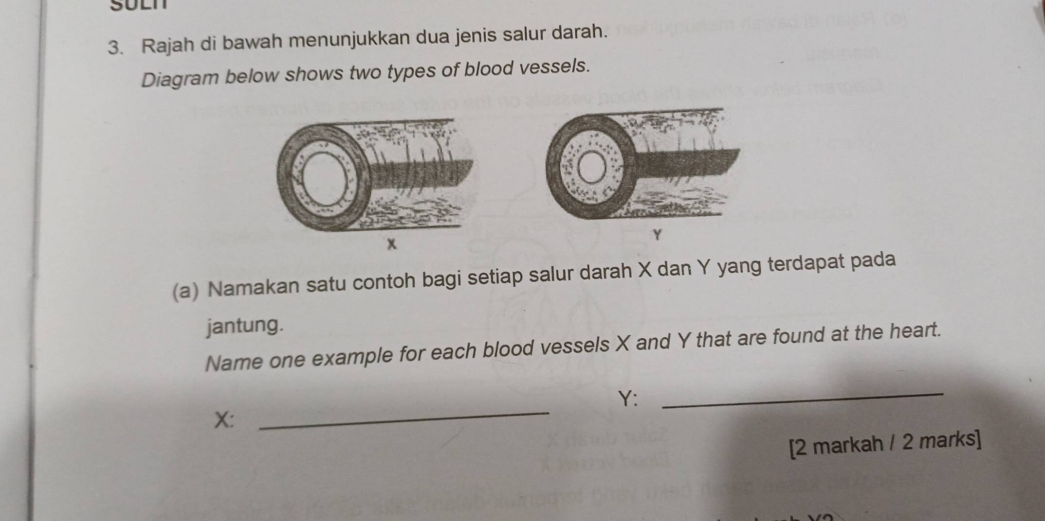 Selesai:Rajah di bawah menunjukkan dua jenis salur darah. Diagram below ...