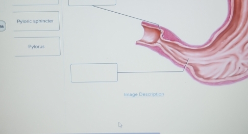 Pyloric sphincter 
Pylorus 
Image Description