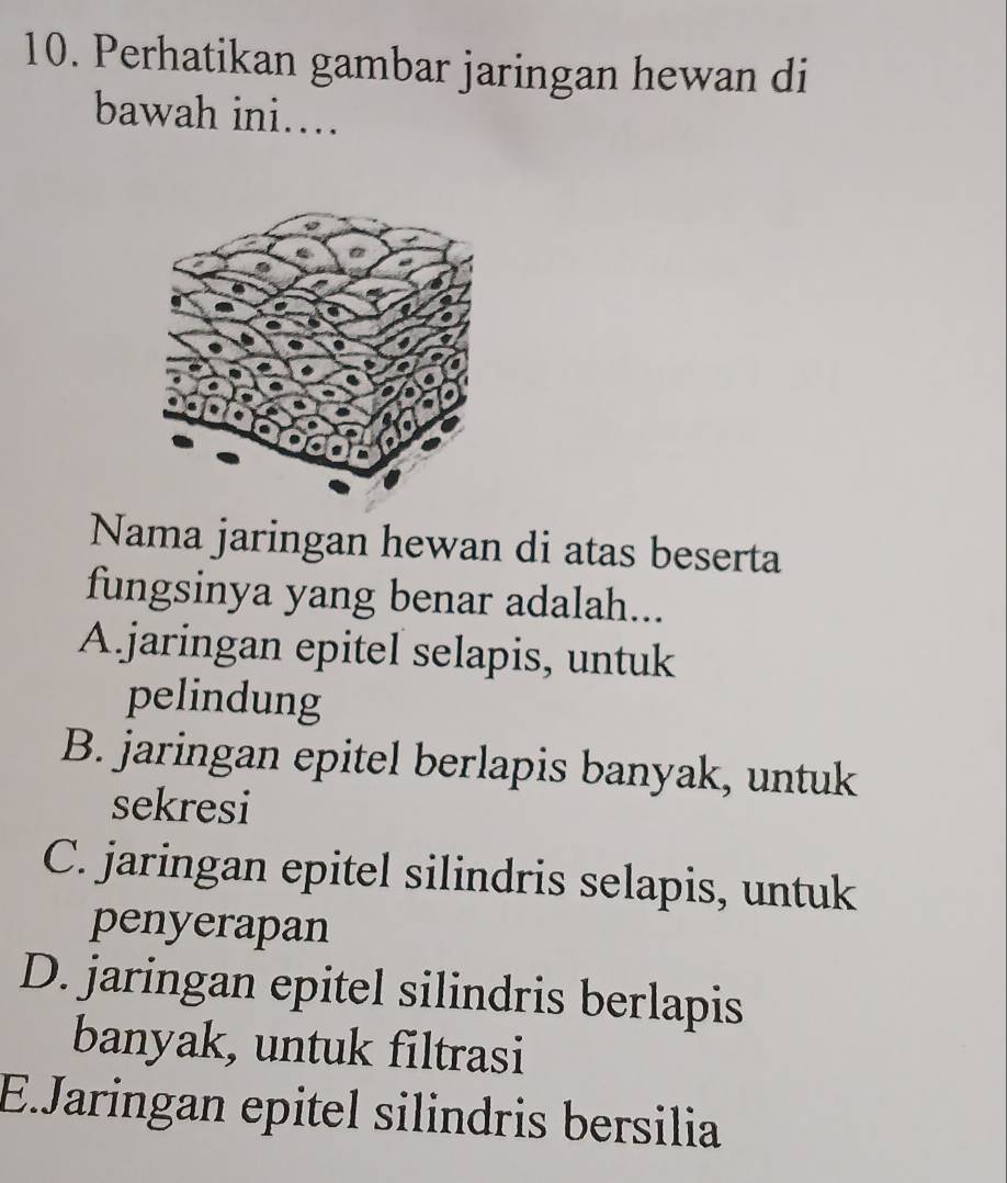 Perhatikan gambar jaringan hewan di
bawah ini…
Nama jaringan hewan di atas beserta
fungsinya yang benar adalah...
A jaringan epitel selapis, untuk
pelindung
B. jaringan epitel berlapis banyak, untuk
sekresi
C. jaringan epitel silindris selapis, untuk
penyerapan
D. jaringan epitel silindris berlapis
banyak, untuk filtrasi
E.Jaringan epitel silindris bersilia