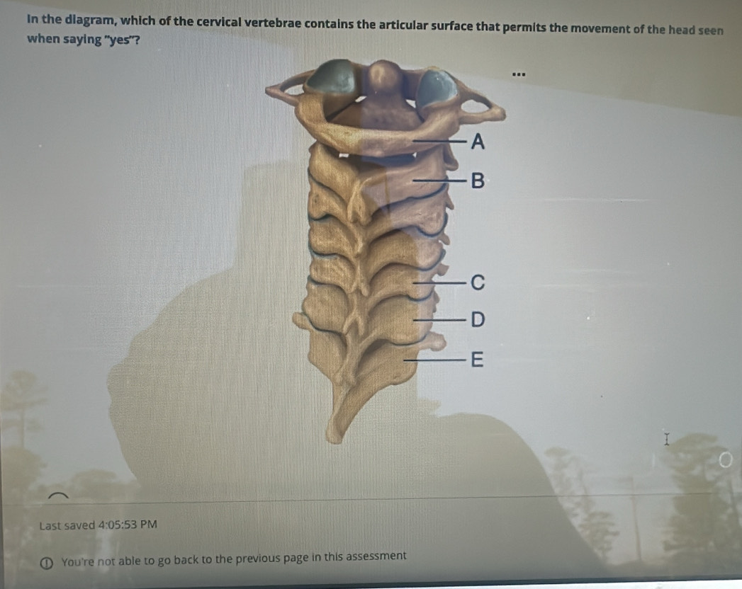 In the diagram, which of the cervical vertebrae contains the articular surface that permits the movement of the head seen 
when saying "yes"? 
I 
Last saved 4:05:53 PM 
D You're not able to go back to the previous page in this assessment