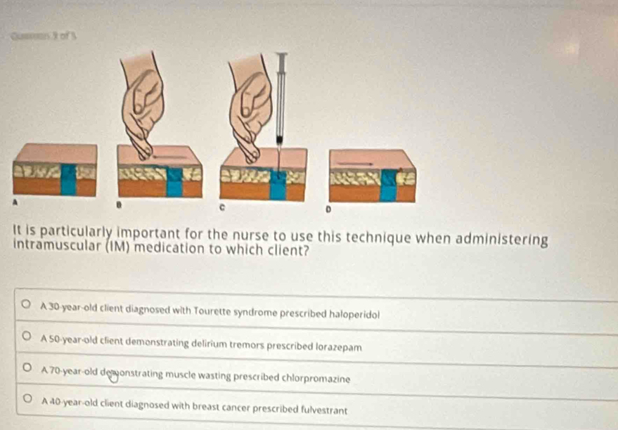 moumrs R of3
It is particularly important for the nurse to use this technique when administering
intramuscular (IM) medication to which client?
A 30-year-old client diagnosed with Tourette syndrome prescribed haloperidol
A 50-year-old client demonstrating delirium tremors prescribed lorazepam
A 70-year-old demonstrating muscle wasting prescribed chlorpromazine
A 40-year-old client diagnosed with breast cancer prescribed fulvestrant