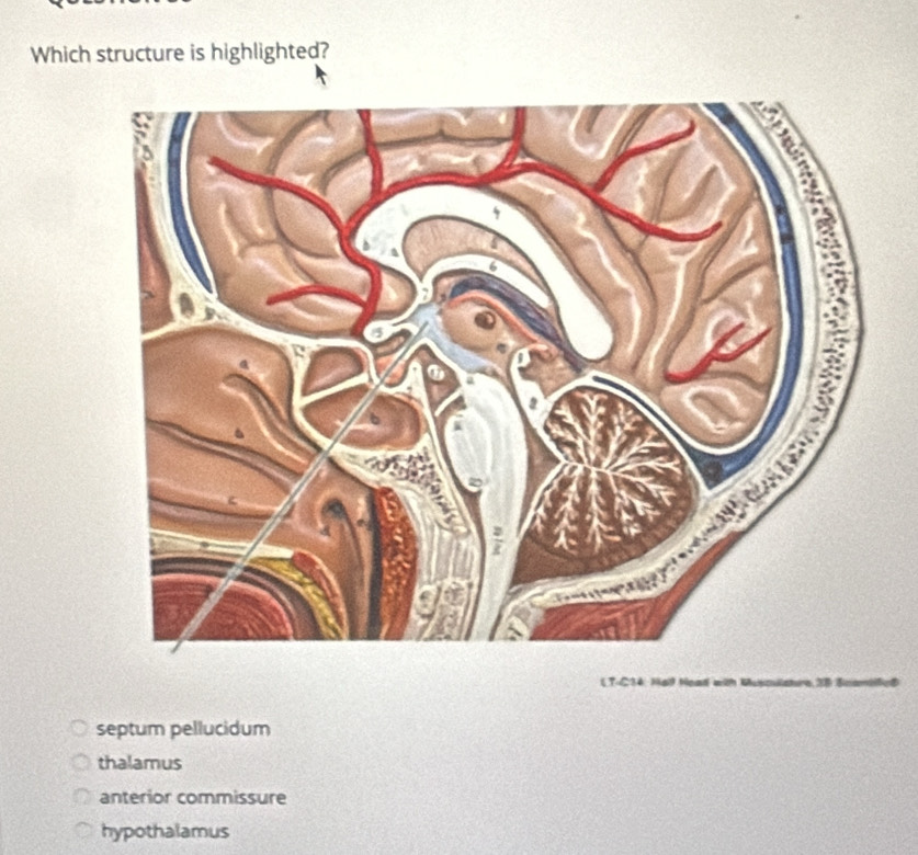 Which structure is highlighted?
LT-C34: Hal Head with Musculature, 38 Scan
septum pellucidum
thalamus
anterior commissure
hypothalamus