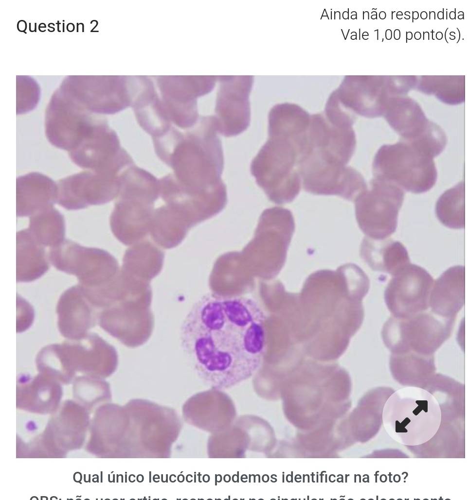 Ainda não respondida 
Question 2 
Vale 1,00 ponto(s). 
Qual único leucócito podemos identificar na foto?