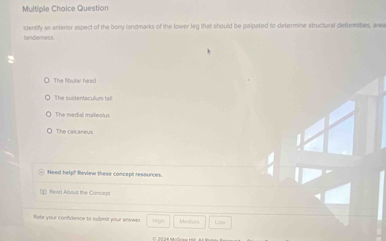 Question
Identify an anterior aspect of the bony landmarks of the lower leg that should be palpated to determine structural deformities, area
tenderness.
The fibular head
The sustentaculum tali
The medial malleolus
The calcaneus
Need help? Review these concept resources.
Read About the Concept
Rate your confidence to submit your answer. High Medium Low
024 McGraw ill A l B