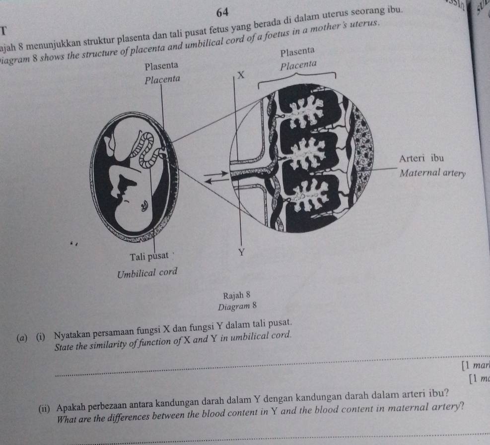 ajah 8 menunjuuktur plasenta dan tali pusat fetus yang berada di dalam uterus seorang ibu. 
T 
iagram 8 show cord of a foetus in a mother's uterus. 
Rajah 8 
Diagram 8 
(a) (i) Nyatakan persamaan fungsi X dan fungsi Y dalam tali pusat. 
_ 
State the similarity of function of X and Y in umbilical cord. 
[1 marl 
[1 m 
(ii) Apakah perbezaan antara kandungan darah dalam Y dengan kandungan darah dalam arteri ibu? 
What are the differences between the blood content in Y and the blood content in maternal artery? 
_