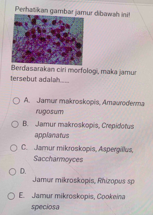 Perhatikan gambar jamur dibawah ini!
Berdasarakan ciri morfologi, maka jamur
tersebut adalah......
A. Jamur makroskopis, Amauroderma
rugosum
B. Jamur makroskopis, Crepidotus
applanatus
C. Jamur mikroskopis, Aspergillus,
Saccharmoyces
D.
Jamur mikroskopis, Rhizopus sp
E. Jamur mikroskopis, Cookeina
speciosa