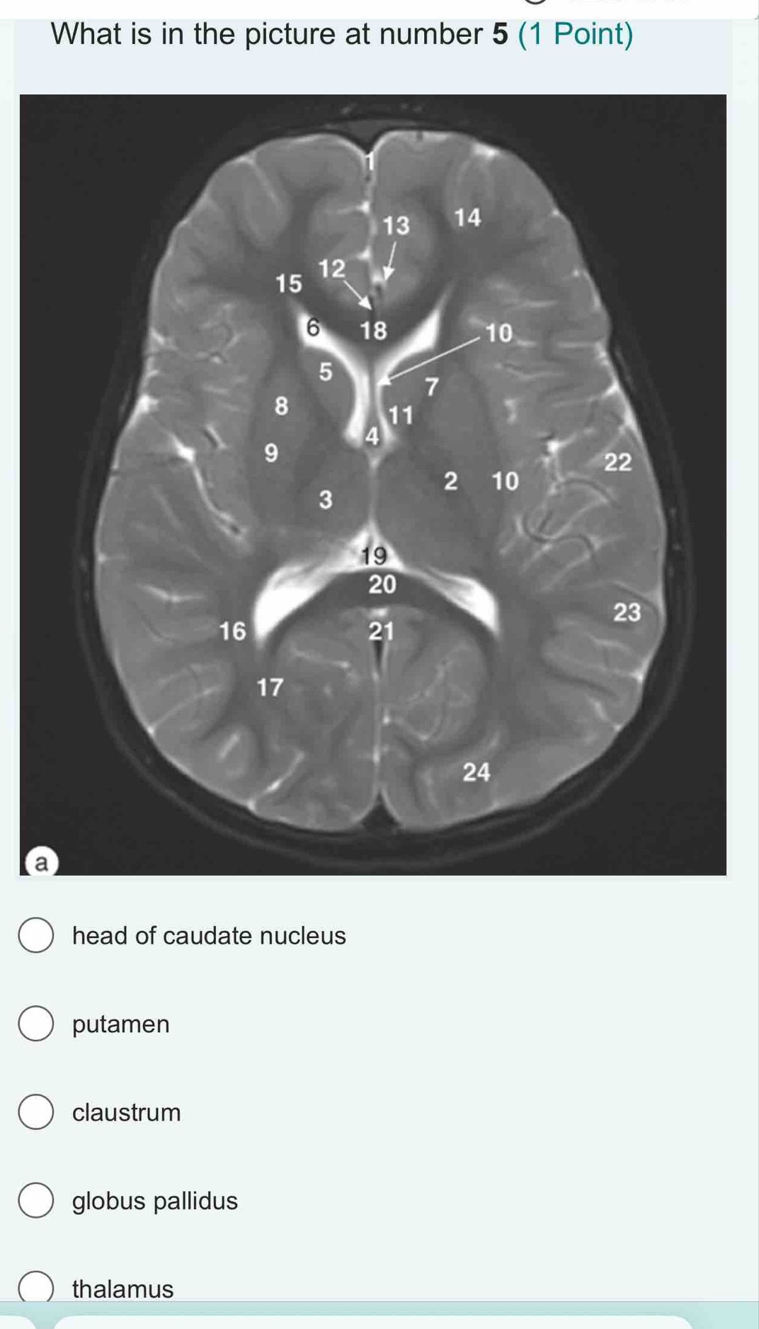 What is in the picture at number 5 (1 Point)
a
head of caudate nucleus
putamen
claustrum
globus pallidus
thalamus