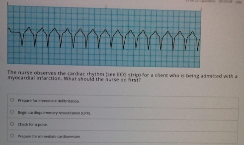 The nurse observes the cardiac rhythm (see ECG strip) for a client who is being admitted with a
myocardial infarction. What should the nurse do first?
Prepare for immediate defibrillation.
Begin cardiopulmonary resuscitation (CPR).
Check for a pulse.
Prepare for immediate cardioversion