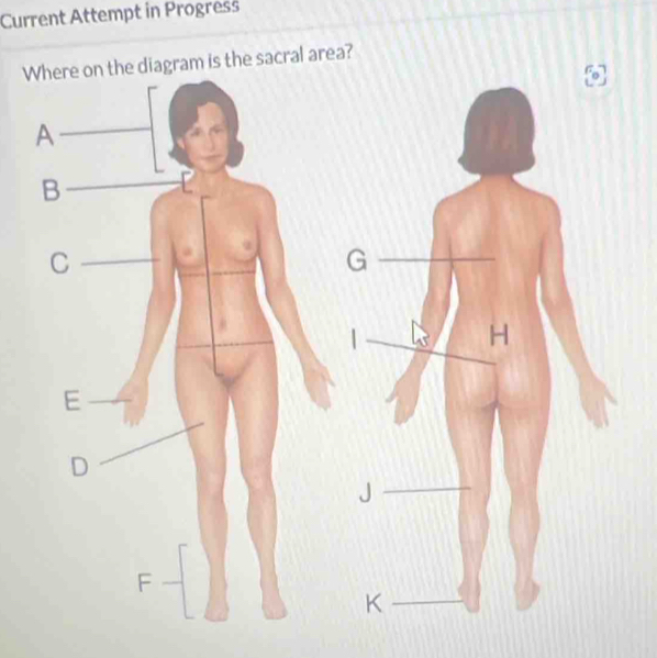 Current Attempt in Progress 
Ws the sacral area?