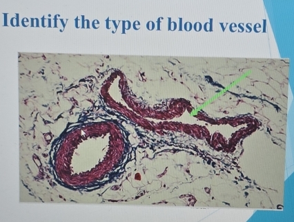 Identify the type of blood vessel