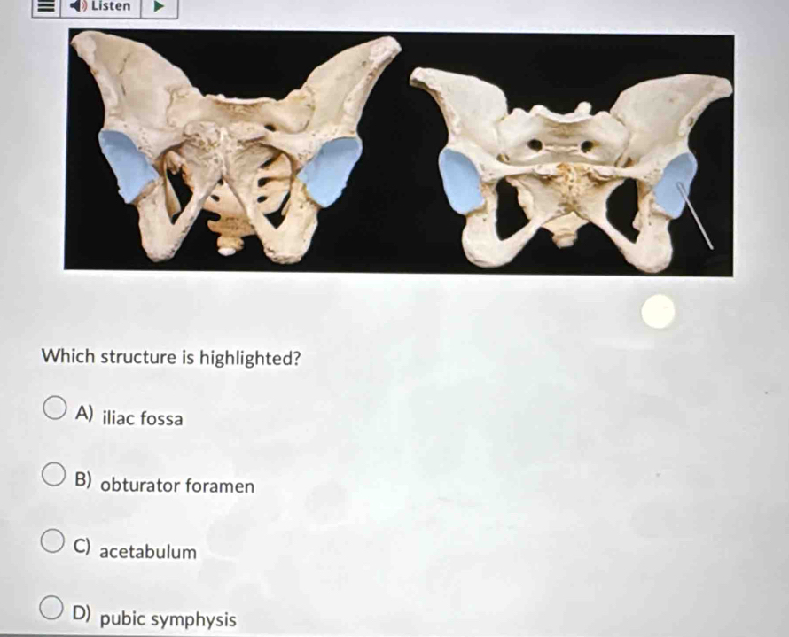 Listen
Which structure is highlighted?
A) iliac fossa
B) obturator foramen
C) acetabulum
D) pubic symphysis