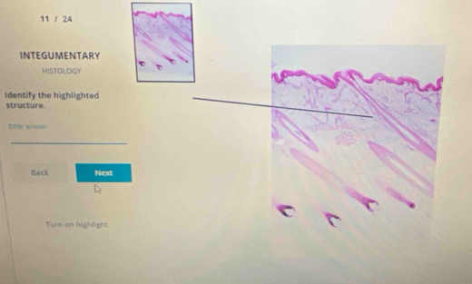 11 / 24 
INTEGUMENTARY 
HISTOLOGY 
Identify the highlighted 
structure 
Enter miidioes 
Back Next 
Turn on highlight